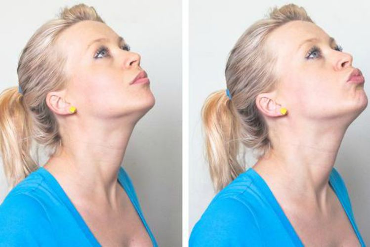 chin lift