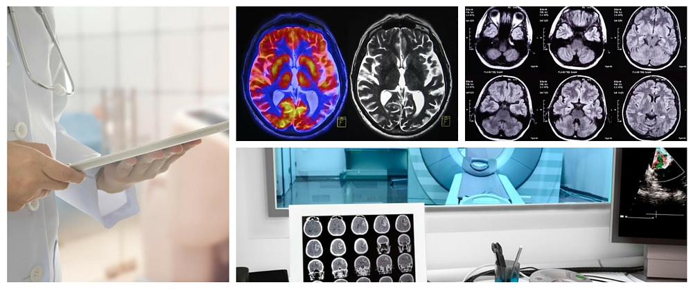 use of mri and ct scan